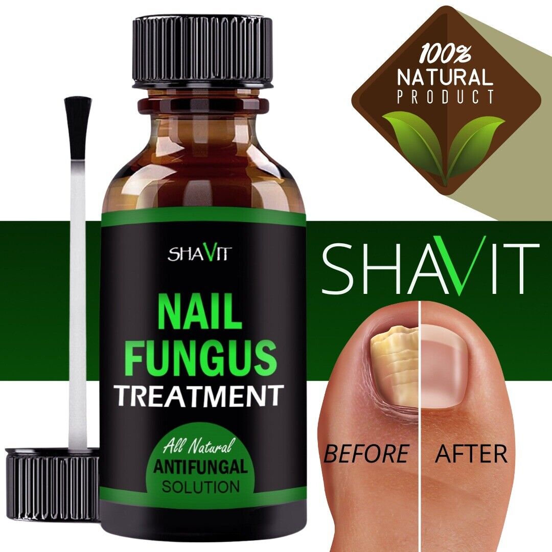 Toenail And Fingernail Fungus Treatment Extra Strength Antifungal Athletes Foot Health DealSniper.net