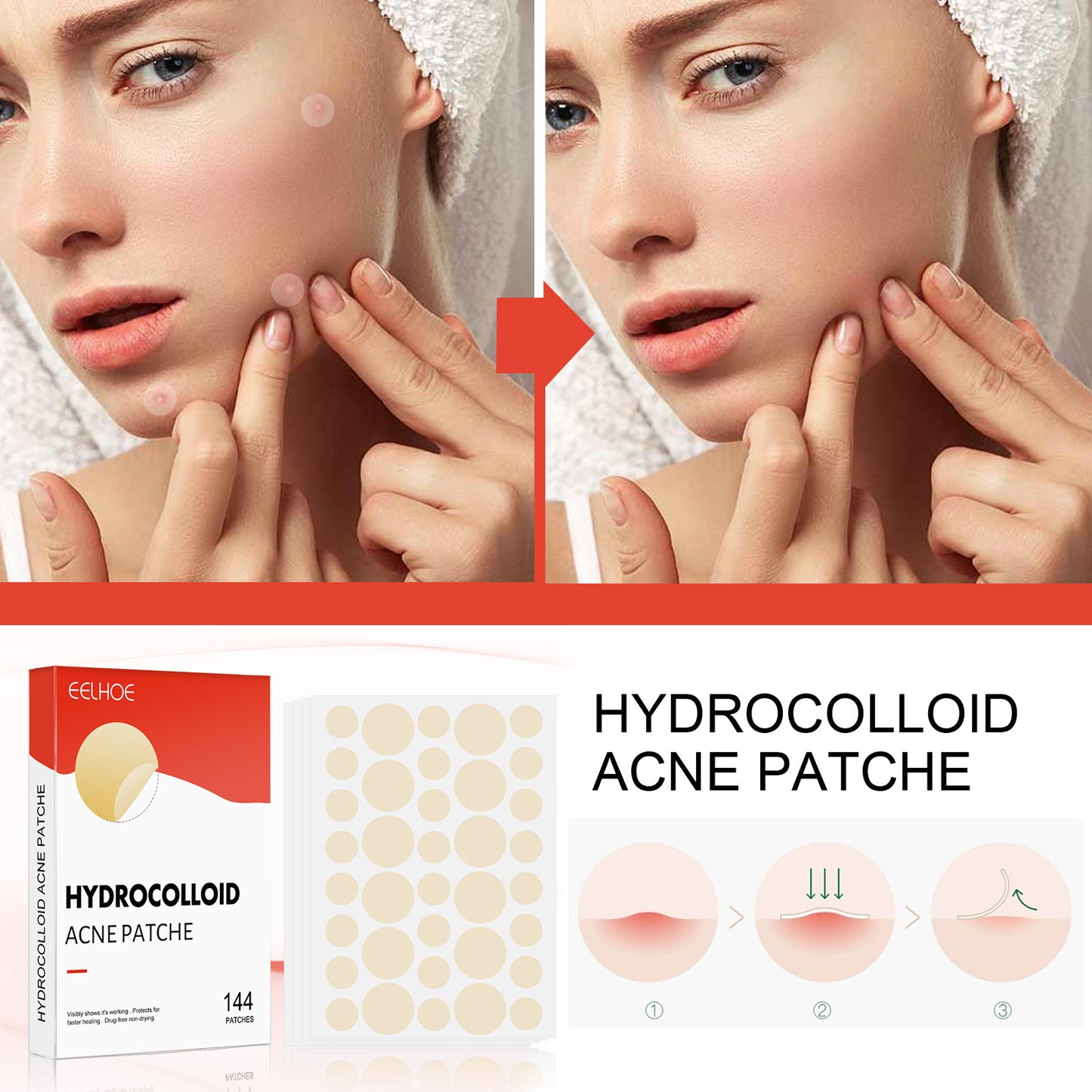 Eelhoe Hydrocolloid Acne Patch Invisible Makeup Closed Beauty DealSniper.net