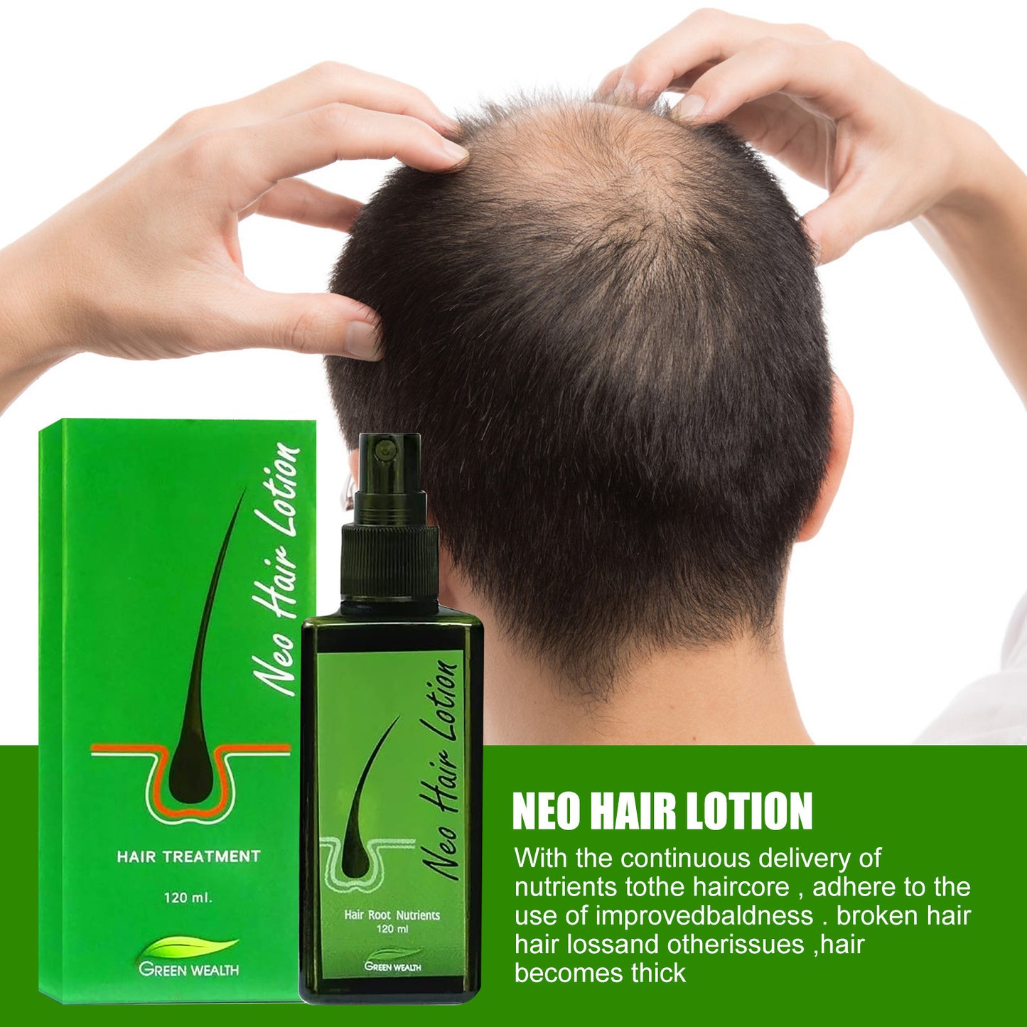 Hair Care Growth Lotion Spray Beauty DealSniper.net