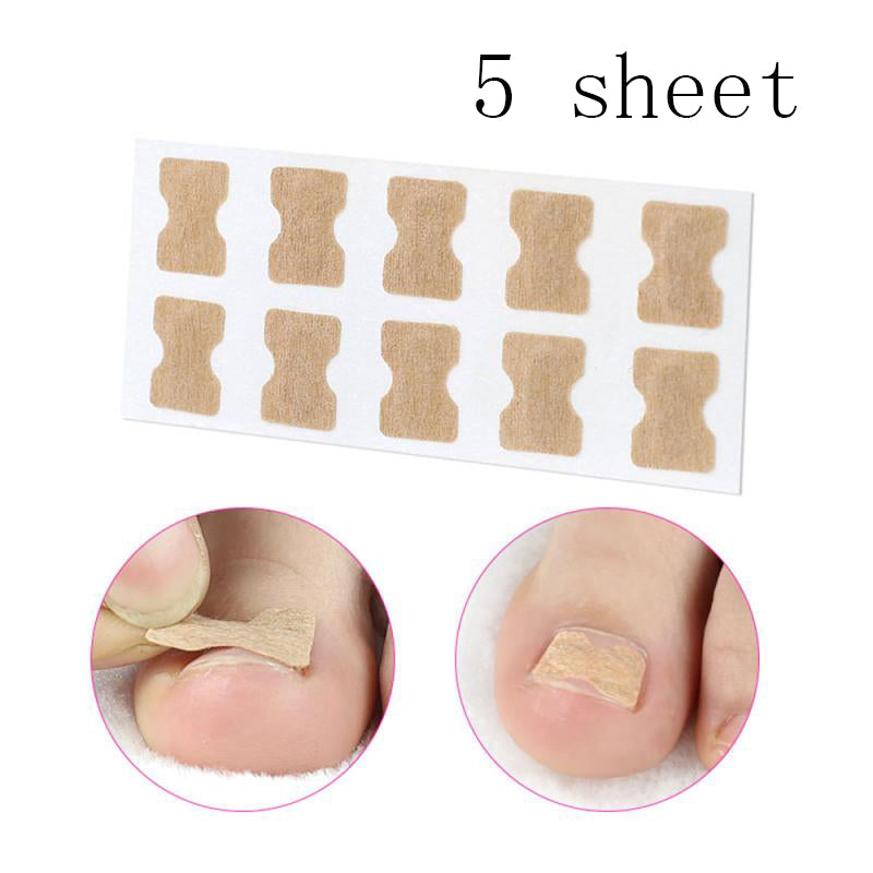 Glue-free orthopaedic nail fixation device Beauty DealSniper.net Beige 5 sheet