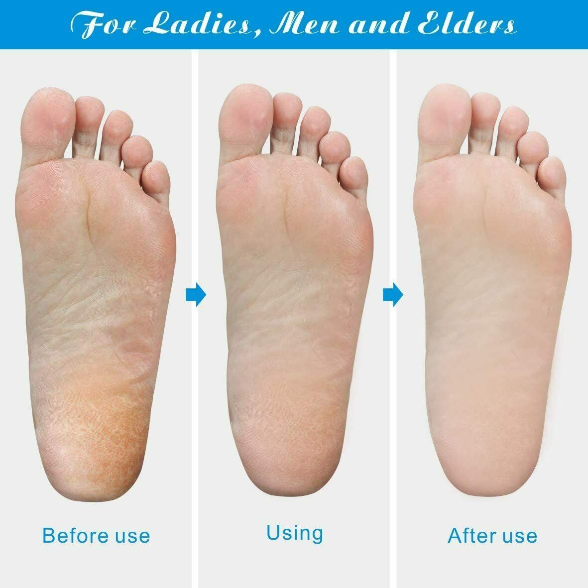 Professional Foot Callus Remover File Rasp Scraper Beauty DealSniper.net