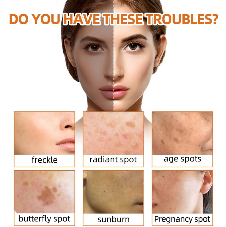 West&Month Turmeric Face Soap Facial Repair Gentle Cleansing Beauty DealSniper.net