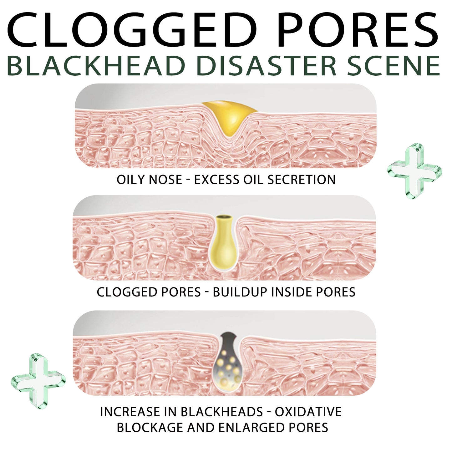 Blackhead Remover Tools 15g Blackhead Cream Beauty DealSniper.net