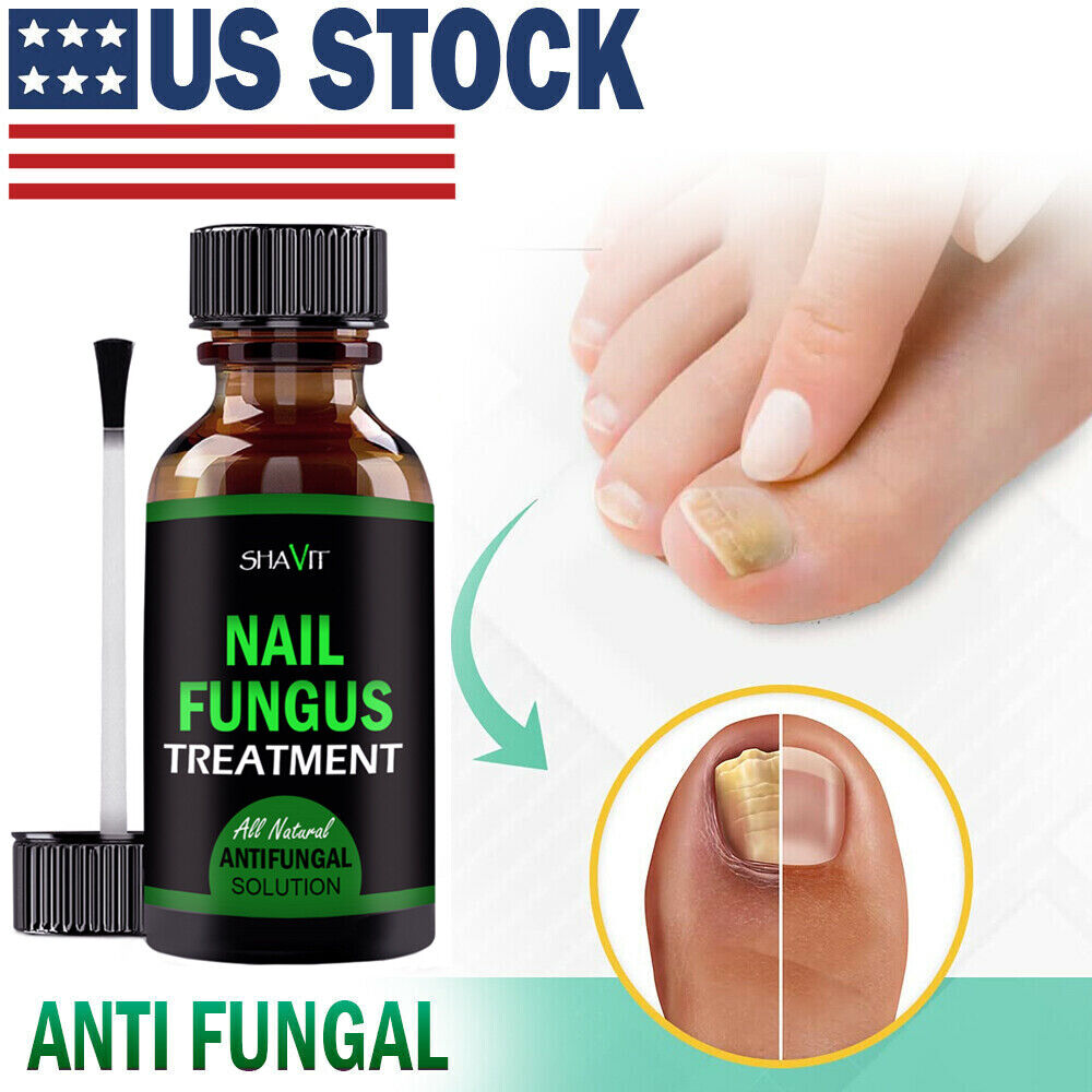 Toenail And Fingernail Fungus Treatment Extra Strength Antifungal Athletes Foot Health DealSniper.net