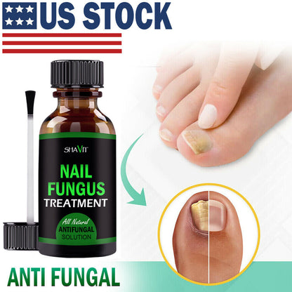 Toenail And Fingernail Fungus Treatment Extra Strength Antifungal Athletes Foot Health DealSniper.net