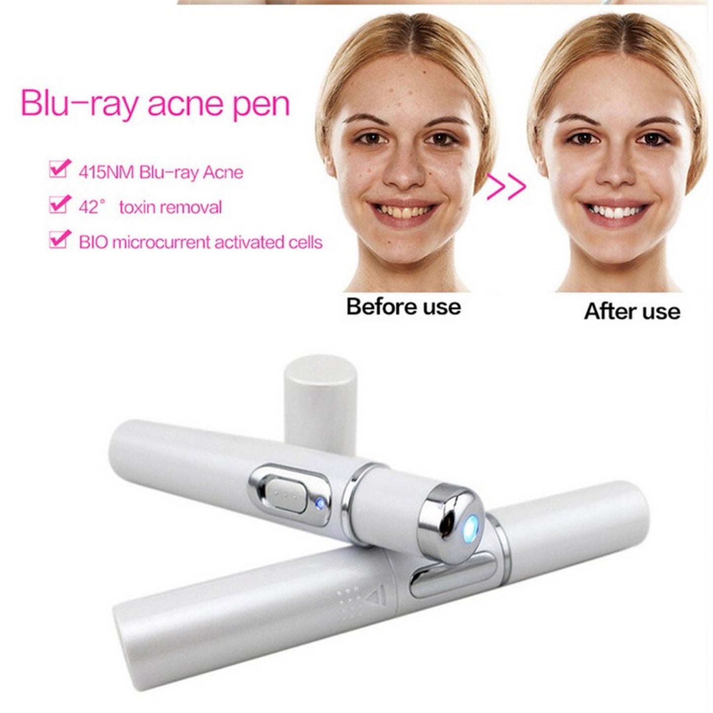 Blue Light Therapy Acne Laser Pen Soft Scar Wrinkle Removal