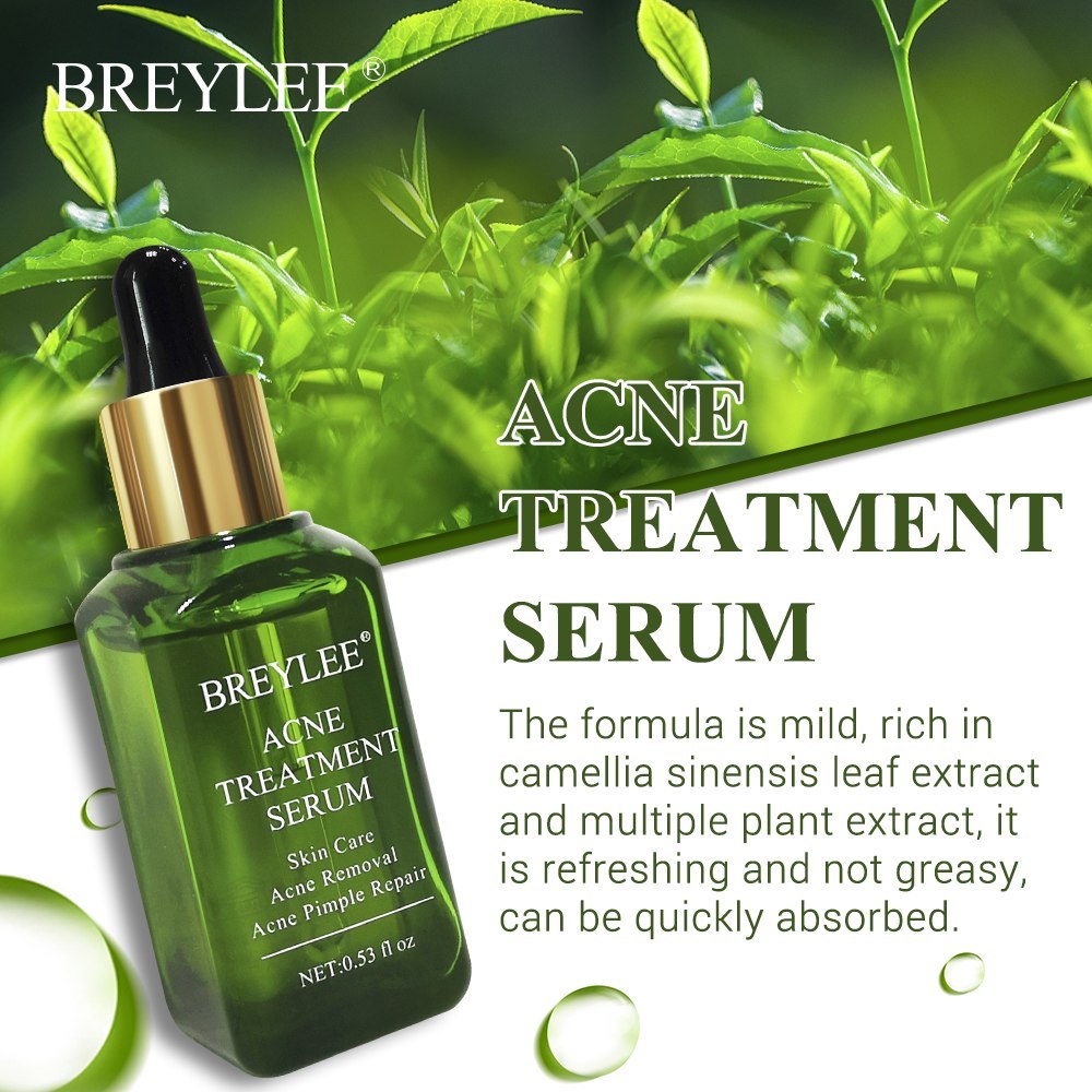 BREYLEE Acne Treatment Serum Face Facial Anti Acne Scar Beauty DealSniper.net