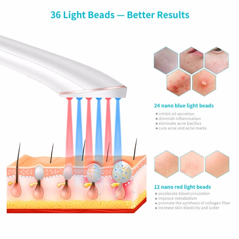 Acne Light Therapy Xpreen Wireless Rechargeable Light Beauty DealSniper.net