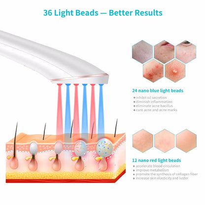 Acne Light Therapy Xpreen Wireless Rechargeable Light Beauty DealSniper.net