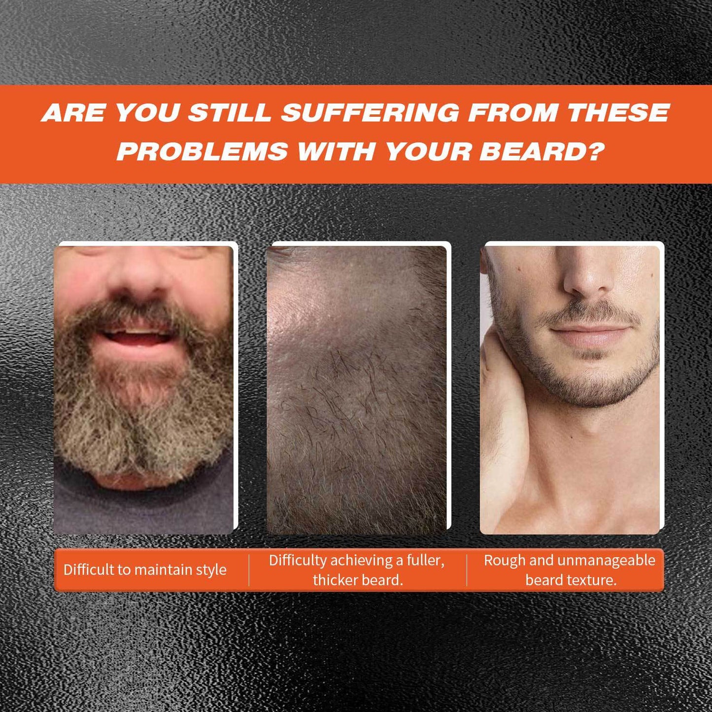 Beard 30ml Microneedle Roller Men Gym From House