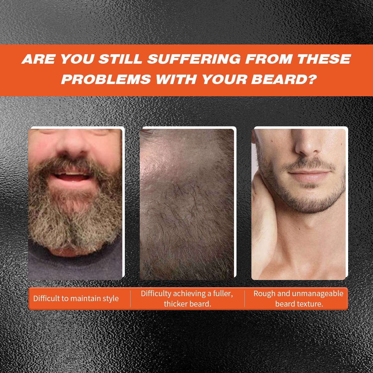 Beard 30ml Microneedle Roller Men Gym From House