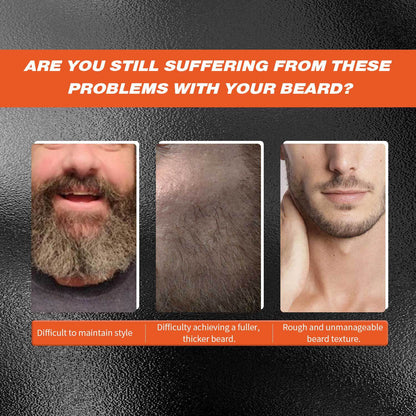 Beard 30ml Microneedle Roller Men Gym From House