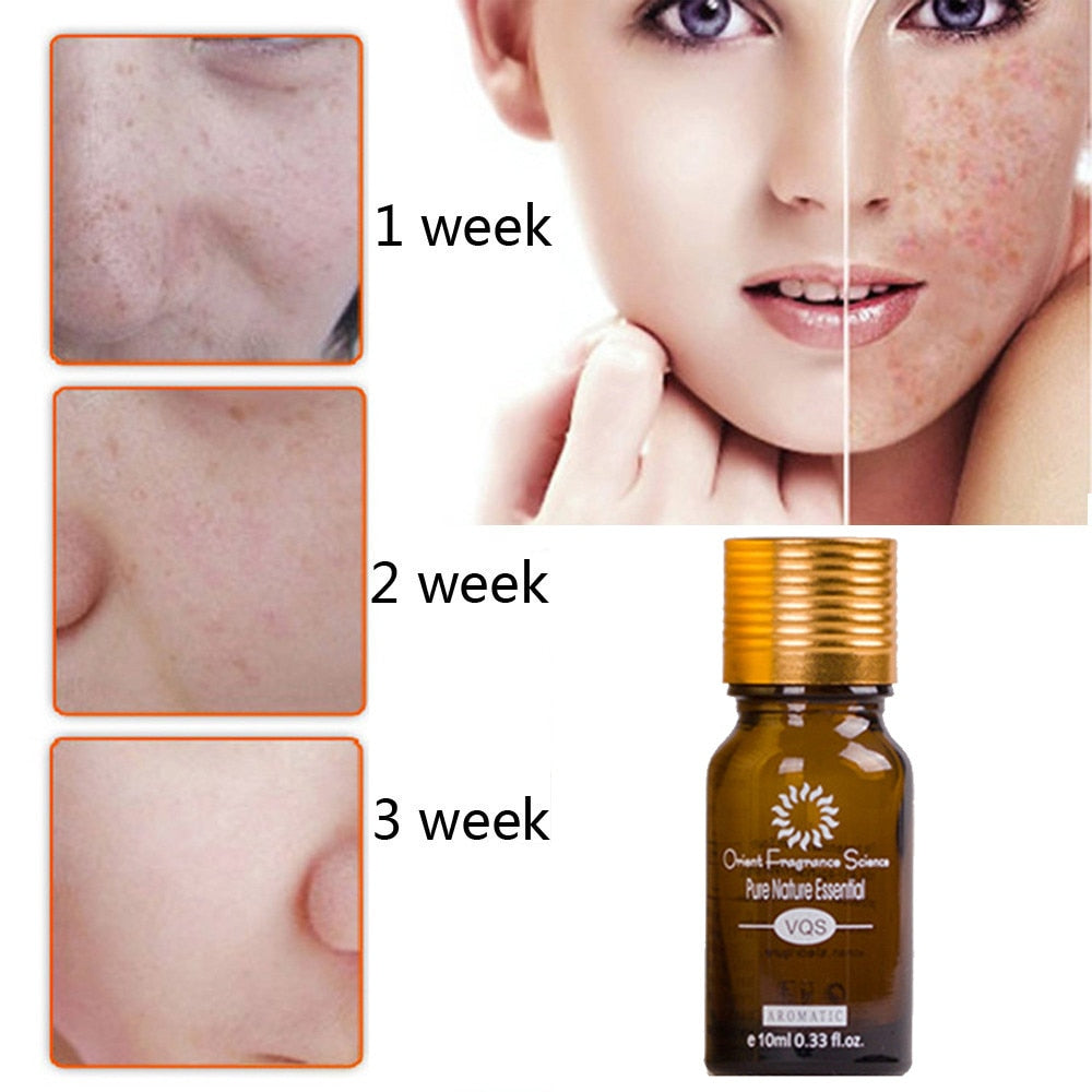 Dredge Meridian Skin Care Natural Pure Removal Acne Stretch Marks Scar Removal Essence oil Beauty dealsniper-net