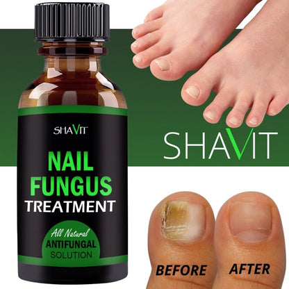 Toenail And Fingernail Fungus Treatment Extra Strength Antifungal Athletes Foot Health DealSniper.net