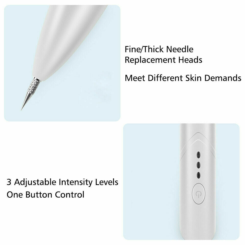 Ion Laser Freckle Skin Mole Dark Spot Remover Face Wart Tag Tattoo Removal Pen Beauty dealsniper-net