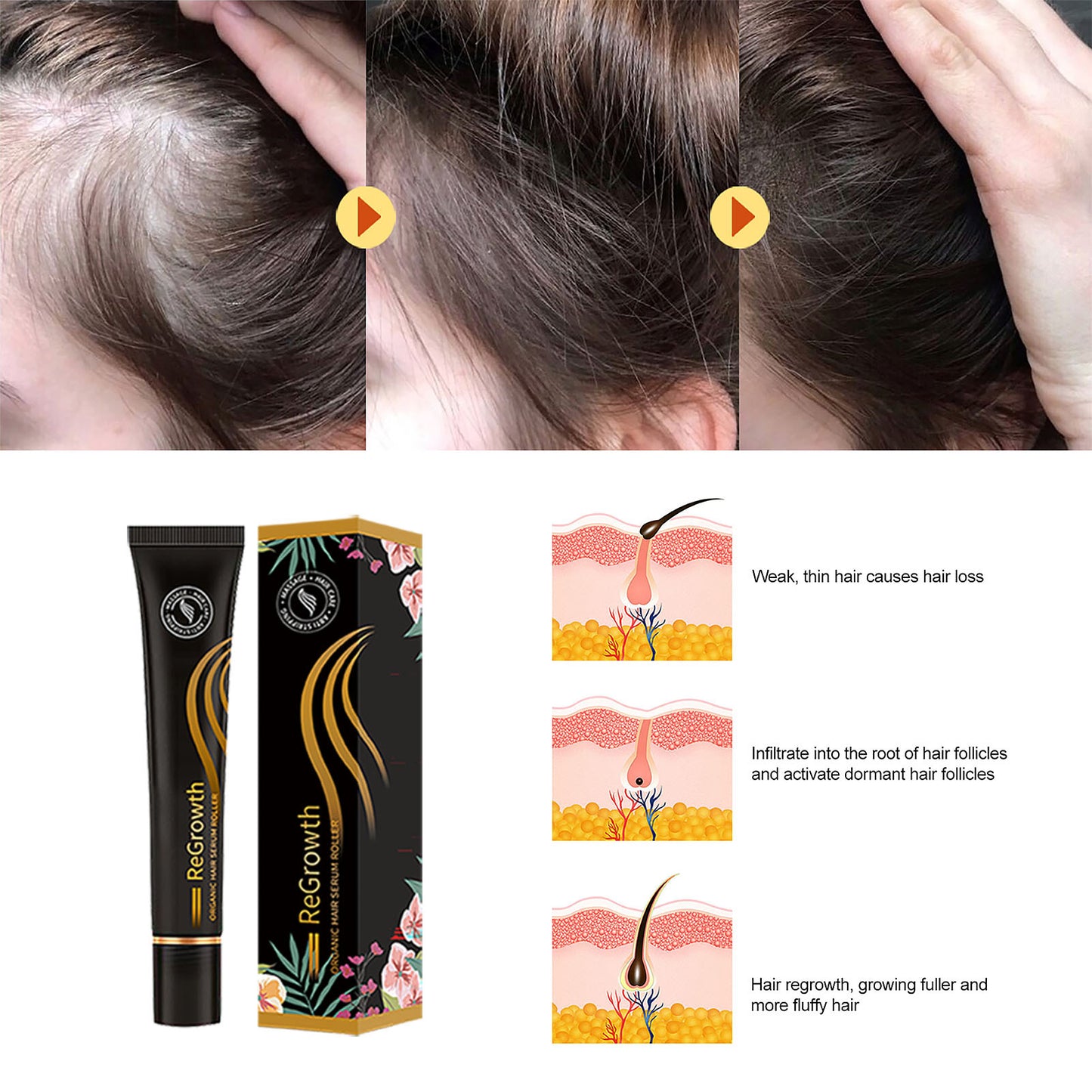 Regrowth Organic Hair Serum Roller Set Hair Care Anti Stripping Deals dealsniper-net