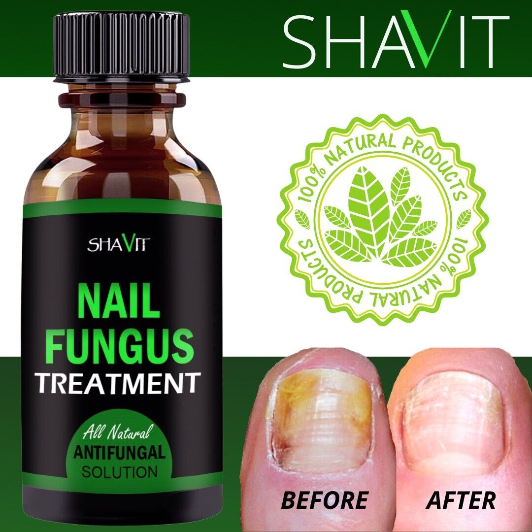 ANTI FUNGAL TREATMENT EXTRA STRENGTH TOENAIL FUNGUS ATHLETES FOOT FUNGI NAIL Health dealsniper-net