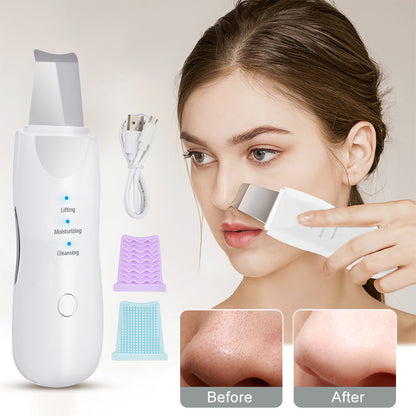 Ultrasonic Skin Scrubber Deep Face Cleaning Machine Peeling Shovel Beauty dealsniper-net