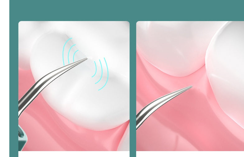 New High-definition Visual Dental Cleaner Health dealsniper-net