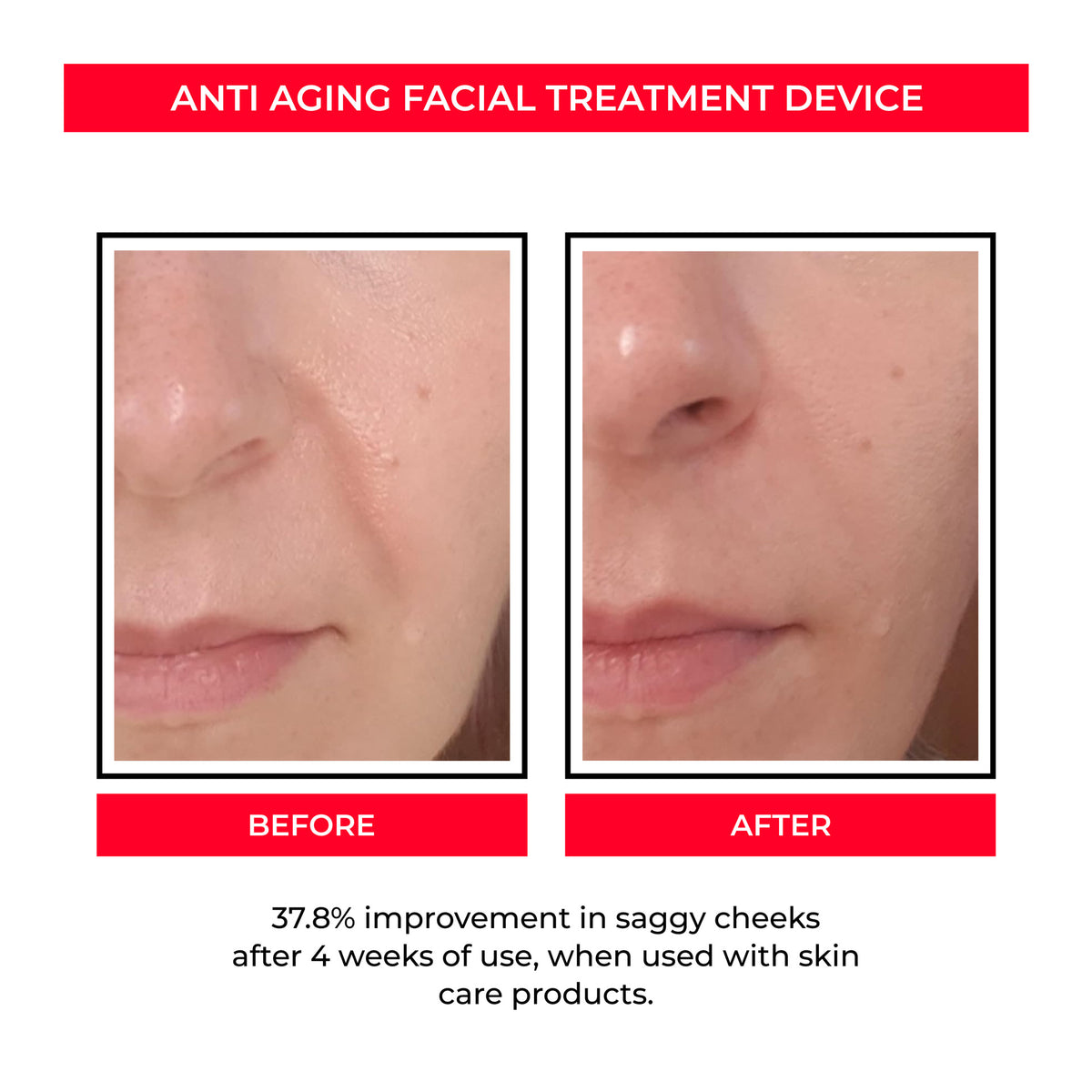 Beauty Instrument Pore Convergence EMS Skin Rejuvenation Micro Current Beauty Gym From House