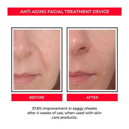 Beauty Instrument Pore Convergence EMS Skin Rejuvenation Micro Current Beauty Gym From House