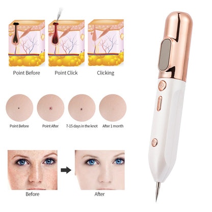 Blue Light Acne Beauty Instrument Beauty dealsniper-net
