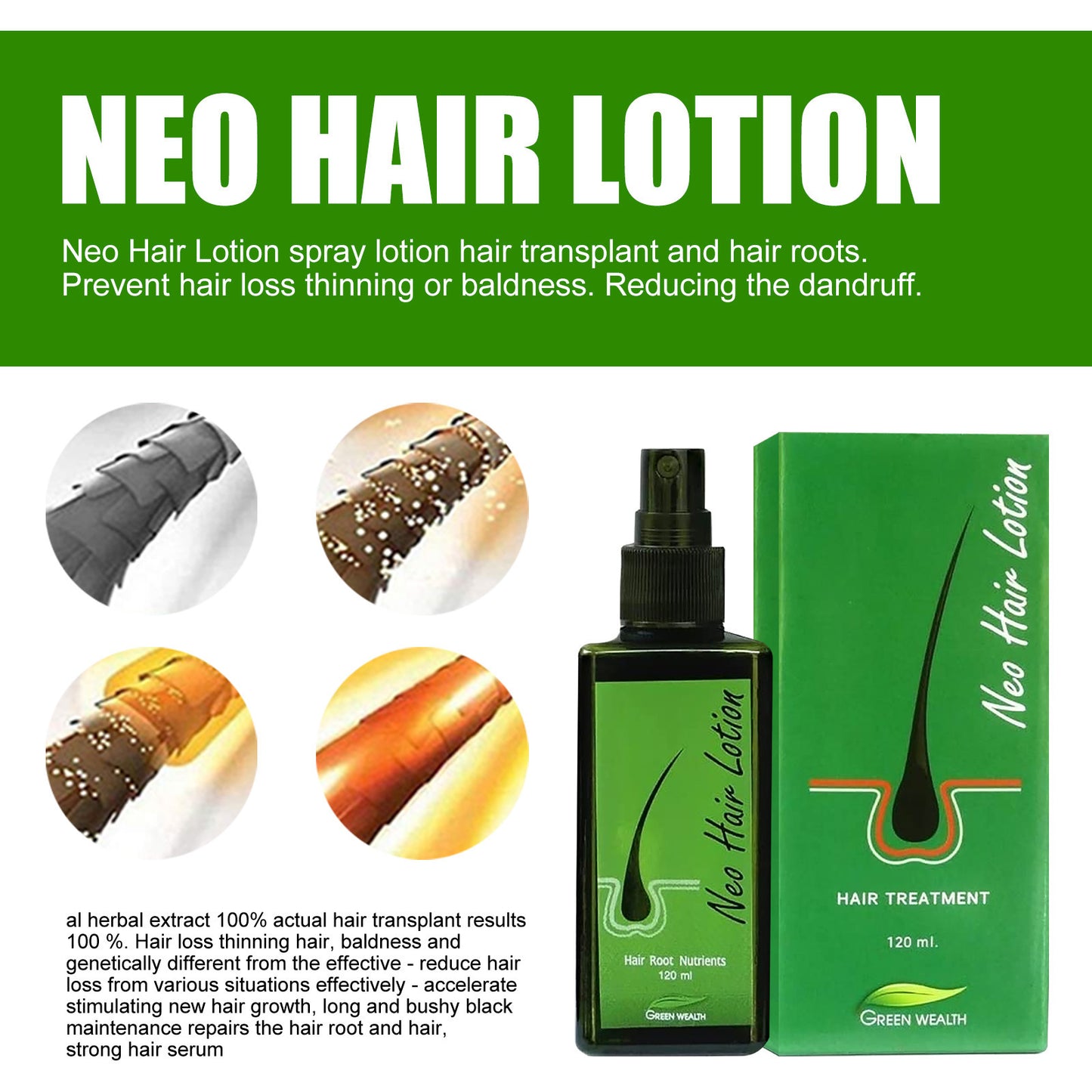 Hair Care Growth Lotion Spray Beauty dealsniper-net