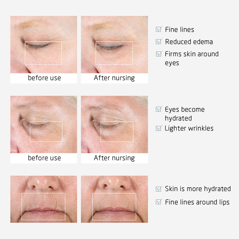 Eye Massager Facial Massager Rechargeable Skin Lifting Machine For Relax Eye Dark Circles, Eye Bags, Wrinkles, Puffiness Under Eyes, White Beauty DealSniper.net
