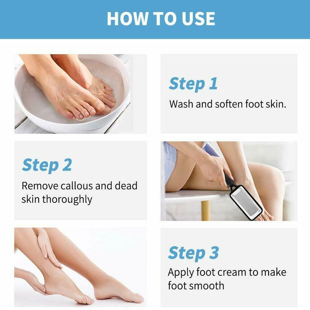 Professional Foot Callus Remover File Rasp Scraper Beauty dealsniper-net