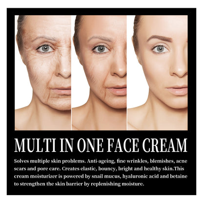 Snail Cream Fading Wrinkle French Lines Replenishment Beauty DealSniper.net