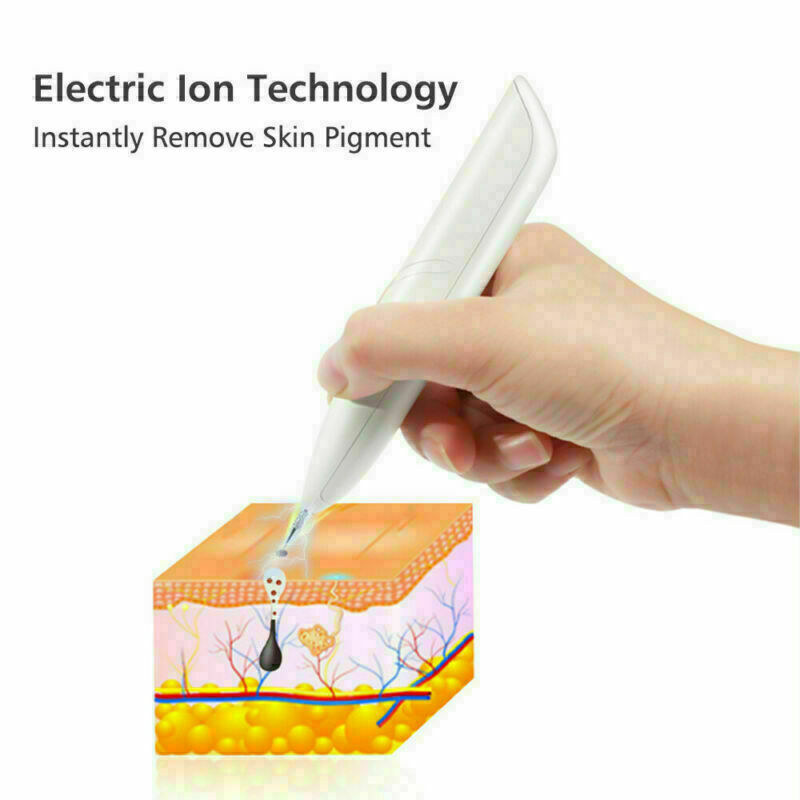 Ion Laser Freckle Skin Mole Dark Spot Remover Face Wart Tag Tattoo Removal Pen Beauty dealsniper-net