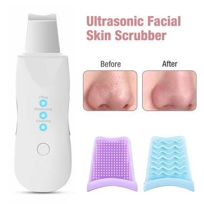 Ultrasonic Skin Scrubber Deep Face Cleaning Machine Peeling Shovel Beauty dealsniper-net