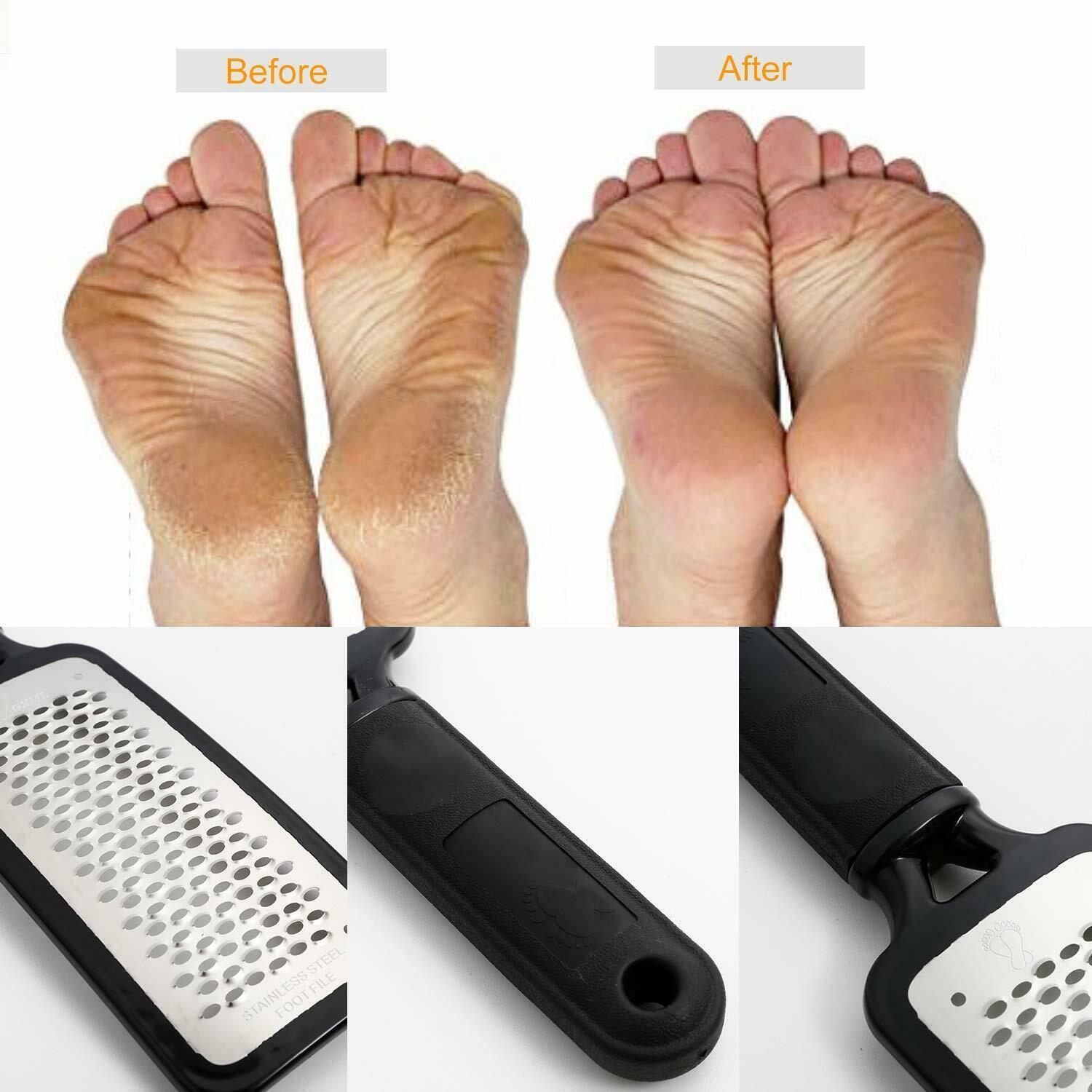 Professional Foot Callus Remover File Rasp Scraper Beauty dealsniper-net