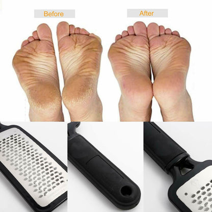 Professional Foot Callus Remover File Rasp Scraper Beauty dealsniper-net