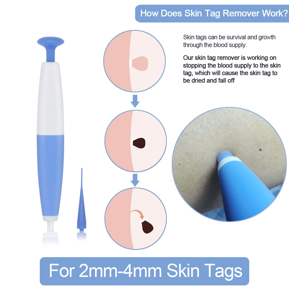 Skin Tag Removal Kit Home Use Mole Wart Remover Micro Band