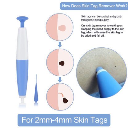 Skin Tag Removal Kit Home Use Mole Wart Remover Micro Band