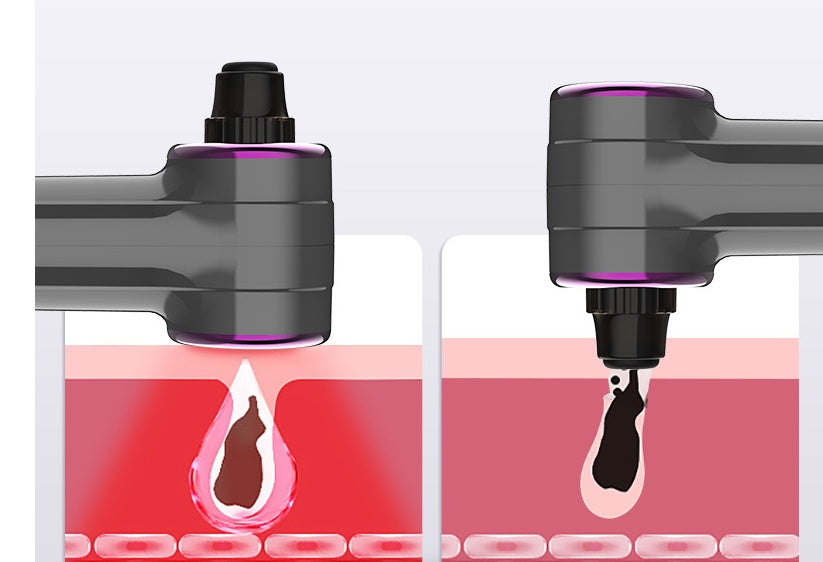 New Electric Blackhead Suction Device For Use Pores Gadgets Gym From House
