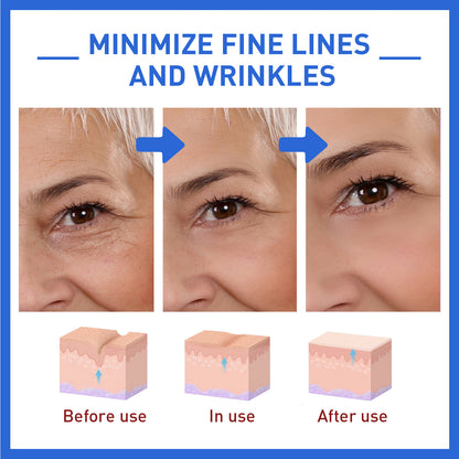 Anti-Wrinkle Essence Firming Head Lifting Pattern French Pattern