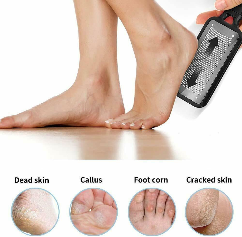 Professional Foot Callus Remover File Rasp Scraper Beauty dealsniper-net