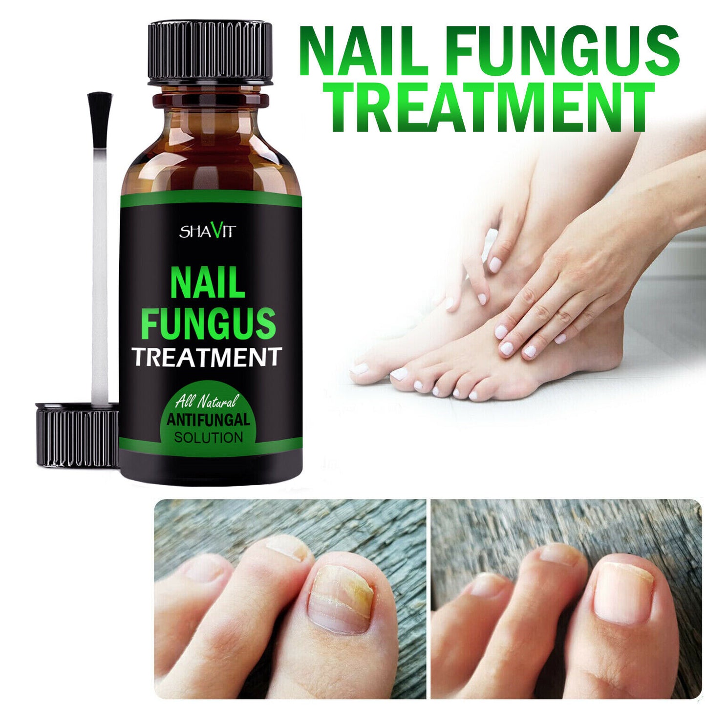 Toenail And Fingernail Fungus Treatment Extra Strength Antifungal Athletes Foot Health DealSniper.net