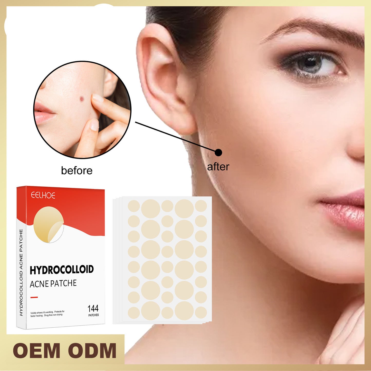 Eelhoe Hydrocolloid Acne Patch Invisible Makeup Closed Beauty dealsniper-net