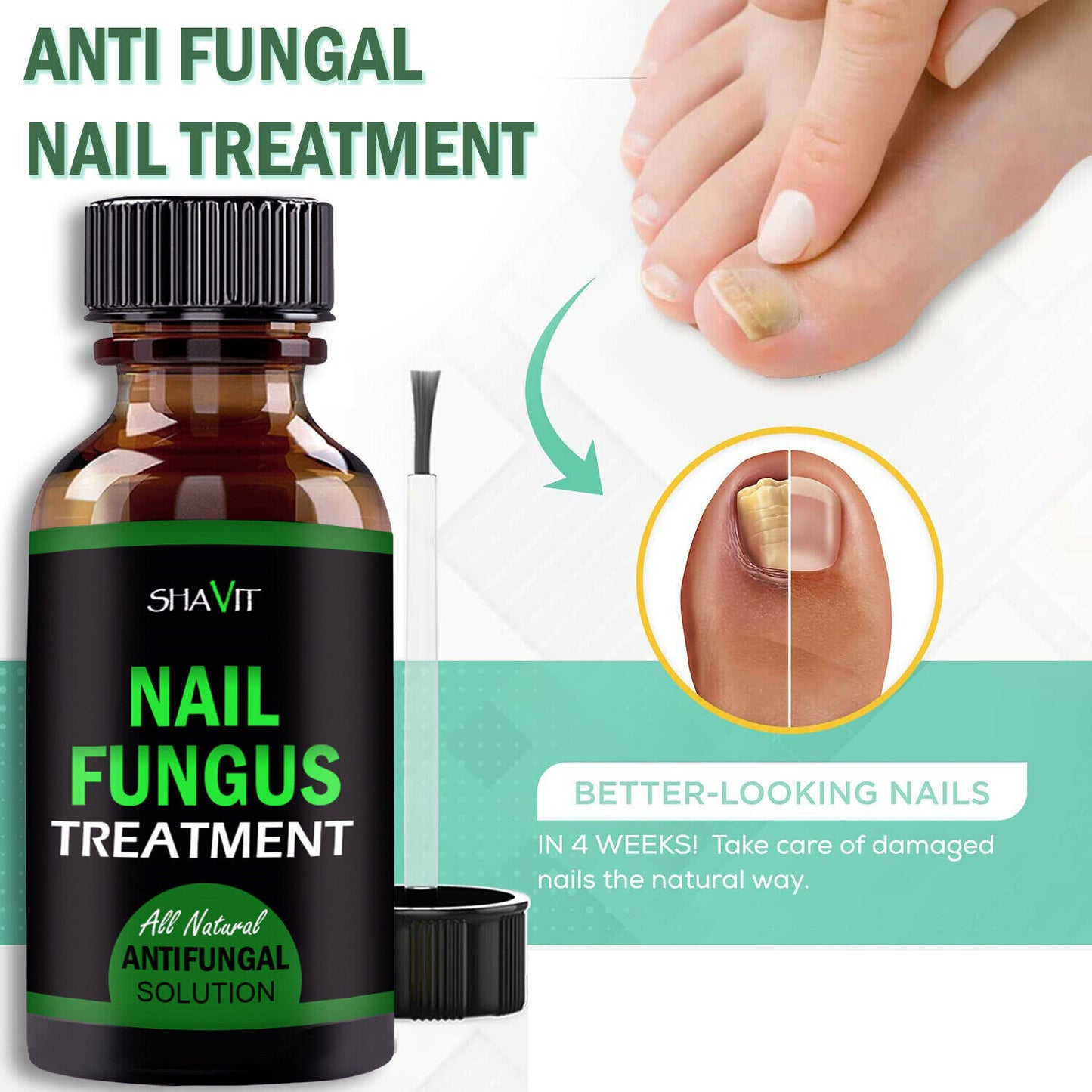 Toenail And Fingernail Fungus Treatment Extra Strength Antifungal Athletes Foot Health DealSniper.net