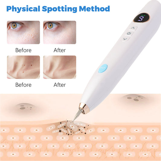 Laser Skin Tag Remover Face Mole Remove Plasma Pen Freckle Removal Machine Plasma Remove Scar Black Spot Face Wart Tattoo Device Beauty dealsniper-net