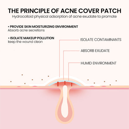 Pimple Patches For Face Hydrocolloid Acne Patches Beauty DealSniper.net