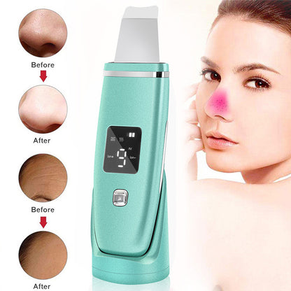 Ultrasonic Vibration Blackhead Remover Deep Cleansing Face Beauty dealsniper-net