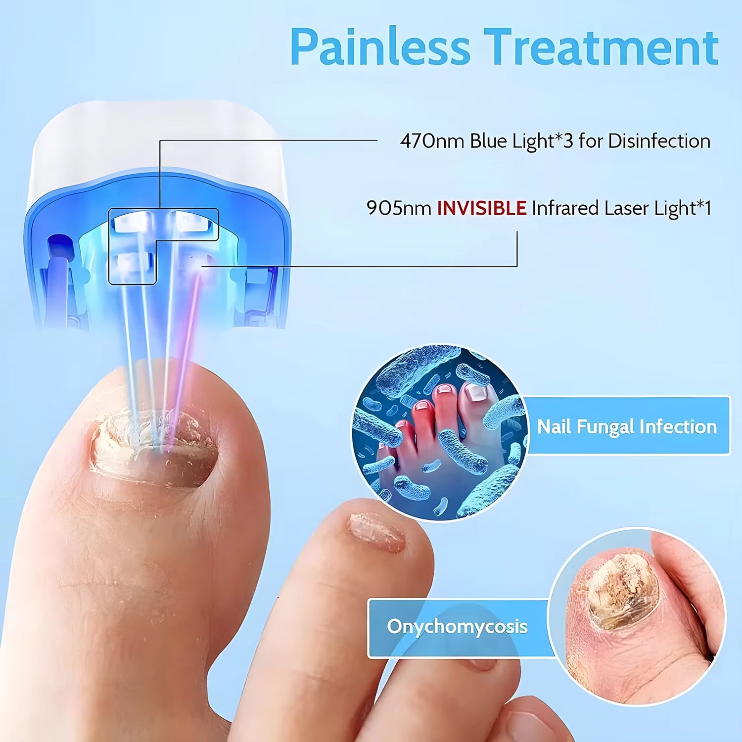 Nail Fungus Laser Treatment LED Light Device Nail Fungus Remover Beauty dealsniper-net