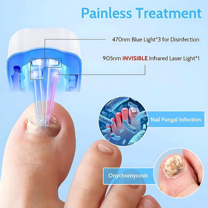 Nail Fungus Laser Treatment LED Light Device Nail Fungus Remover Beauty dealsniper-net