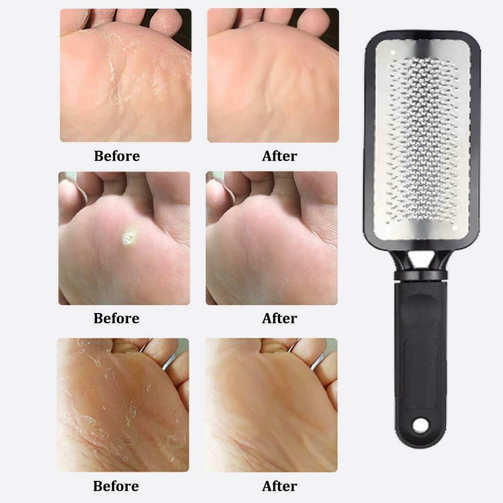 Professional Foot Callus Remover File Rasp Scraper Beauty dealsniper-net