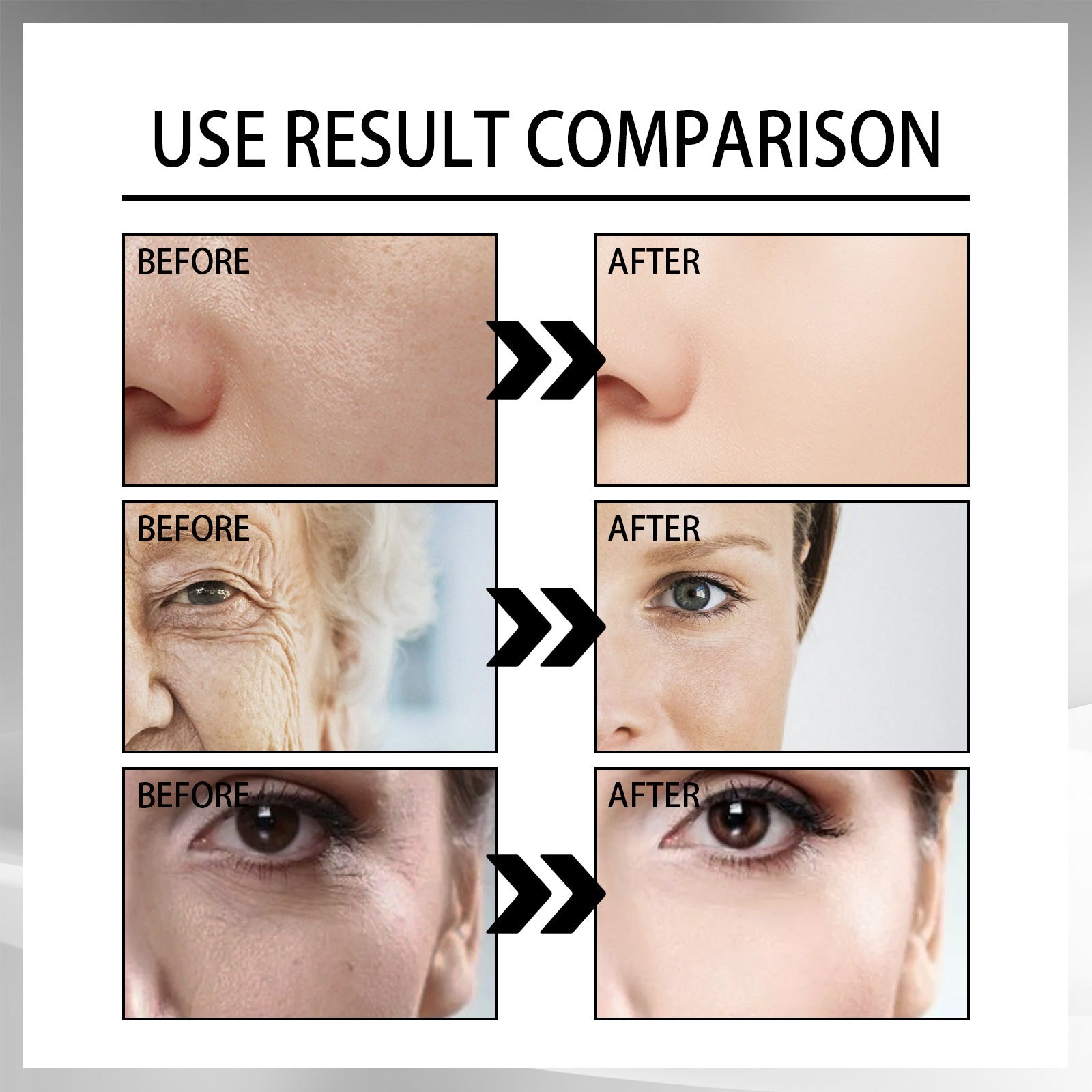 Snail Cream Fading Wrinkle French Lines Replenishment Beauty DealSniper.net
