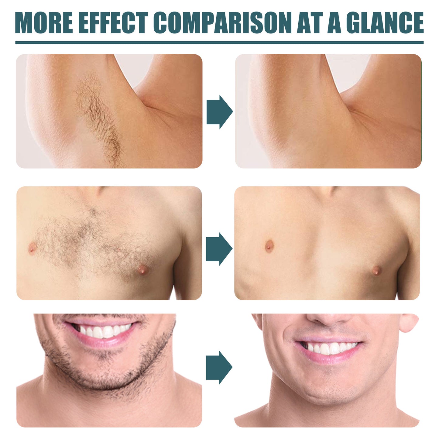 Men's Hair Removal Cream Is Clean And Gentle Men Gym From House